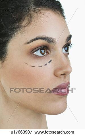 Stock Photo - Closeup of patient's face with distance marker. Fotosearch