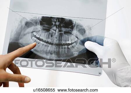 Dental panoramic xray View Large Photo Image Stock Photography - Dental panoramic xray. Fotosearch