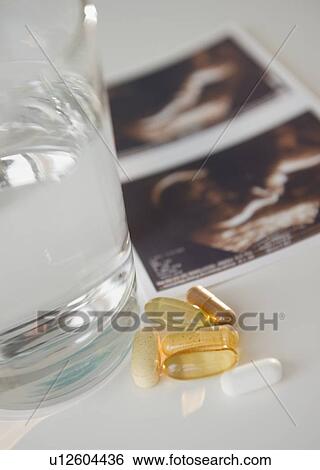 Sonogram picture, pills and glass of water View Large Photo Image Stock Photograph - Sonogram picture, pills and glass of water. Fotosearch