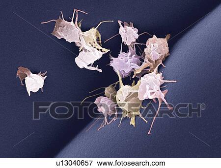 Stock Photo - Activated platelets, SEM. Fotosearch