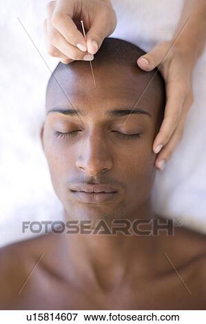 Acupuncture View Large Photo Image Stock Photo - Acupuncture. Fotosearch