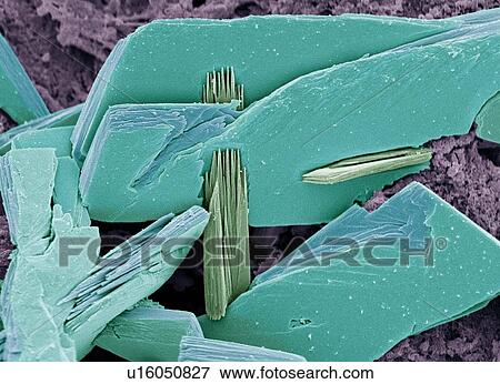 Stock Photo - Albumen crystals, SEM. Fotosearch