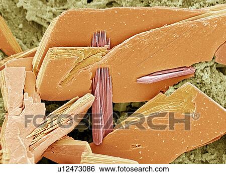 Stock Photograph - Albumen crystals, SEM. Fotosearch
