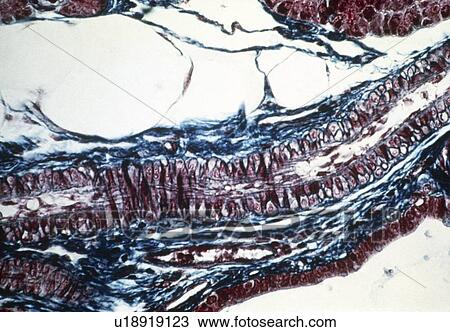 Stock Image - Arteriole. Fotosearch