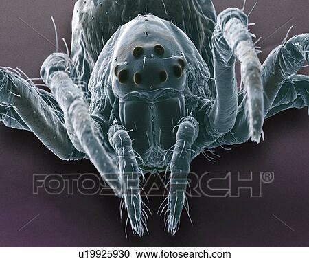 Stock Image - Baby spider, SEM. Fotosearch