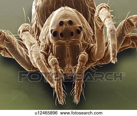 Baby spider, SEM View Large Photo Image Stock Photograph - Baby spider, SEM. Fotosearch