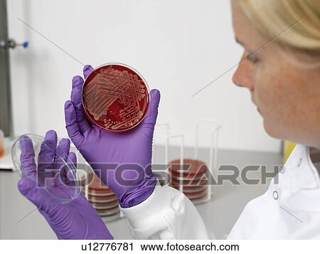 Stock Image - Bacterial contamination tests. Fotosearch