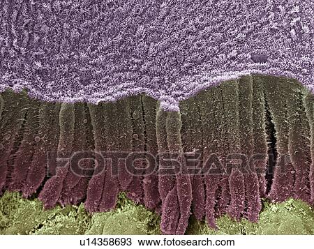 Bile duct, SEM View Large Photo Image Stock Image - Bile duct, SEM. Fotosearch