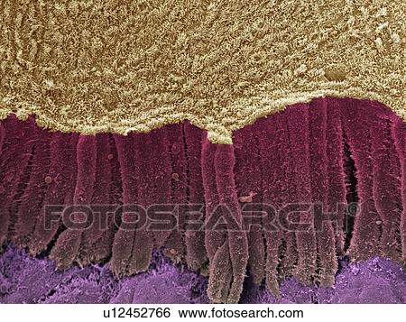 Stock Photograph - Bile duct, SEM. Fotosearch