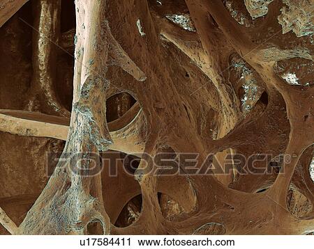 Bird bone, SEM View Large Photo Image Stock Image - Bird bone, SEM. Fotosearch