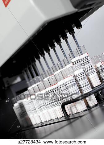 Picture - Blood analysis. Fotosearch