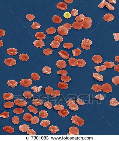 Stock Image - Blood cells, SEM. Fotosearch