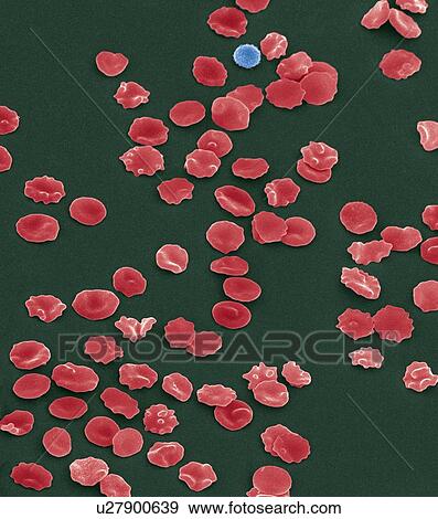 Stock Photo - Blood cells, SEM. Fotosearch