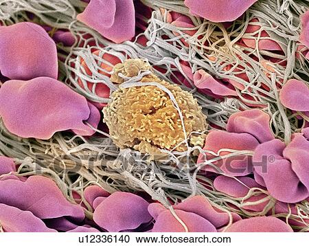 Blood clot, SEM View Large Photo Image Stock Image - Blood clot, SEM. Fotosearch