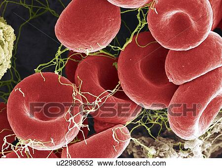 Blood clot, SEM View Large Photo Image Stock Image - Blood clot, SEM. Fotosearch