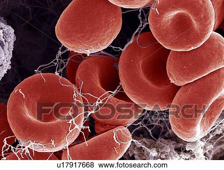 Blood clot, SEM View Large Photo Image Stock Photo - Blood clot, SEM. Fotosearch