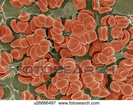 Stock Photo - Blood clot, SEM. Fotosearch