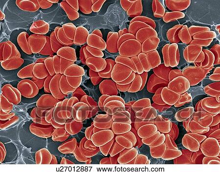 Blood clot, SEM View Large Photo Image Stock Photo - Blood clot, SEM. Fotosearch