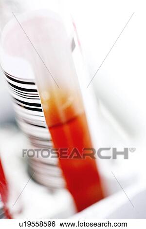 Blood sample View Large Photo Image Stock Photograph - Blood sample. Fotosearch