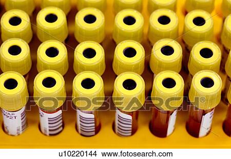 Blood samples View Large Photo Image Picture - Blood samples. Fotosearch
