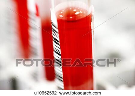 Stock Image - Blood samples. Fotosearch