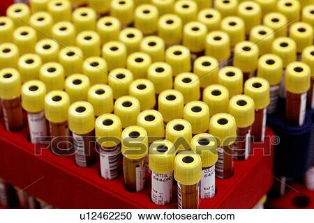 Blood samples View Large Photo Image Stock Image - Blood samples. Fotosearch