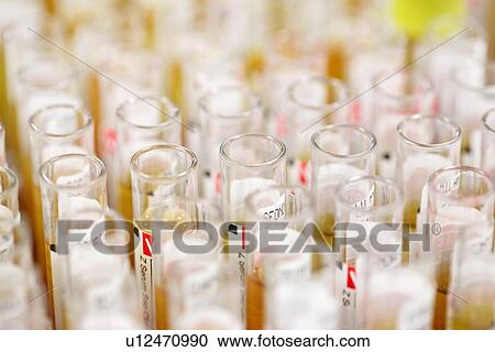 Blood samples View Large Photo Image Stock Image - Blood samples. Fotosearch