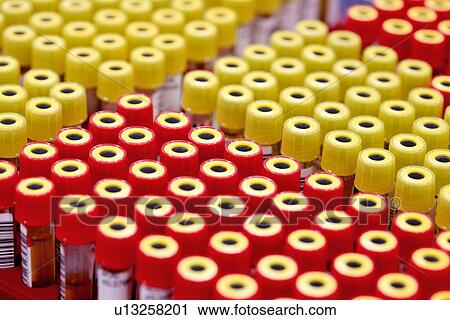 Blood samples View Large Photo Image Stock Image - Blood samples. Fotosearch