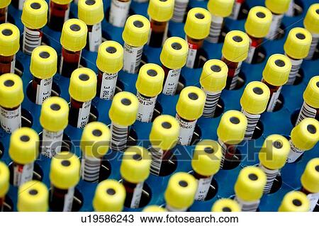 Stock Image - Blood samples. Fotosearch
