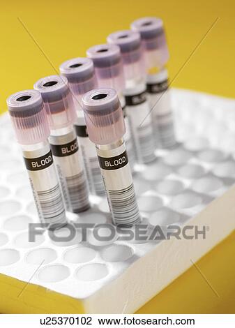 Blood samples View Large Photo Image Stock Image - Blood samples. Fotosearch