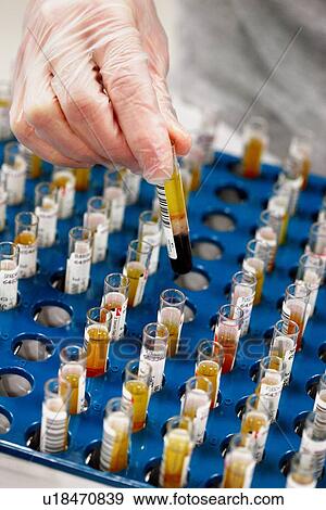 Stock Photo - Blood samples. Fotosearch