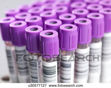 Blood samples View Large Photo Image Stock Photo - Blood samples. Fotosearch
