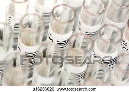 Blood samples View Large Photo Image Stock Photograph - Blood samples. Fotosearch