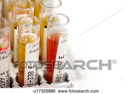 Blood samples View Large Photo Image Stock Photograph - Blood samples. Fotosearch