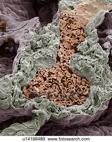 Stock Photo - Blood vessel in the lung, SEM. Fotosearch