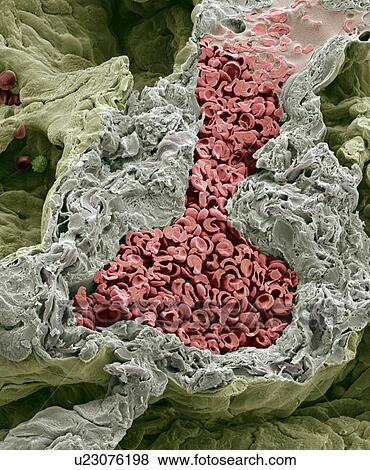 Blood vessel in the lung, SEM View Large Photo Image Stock Photo - Blood vessel in the lung, SEM. Fotosearch