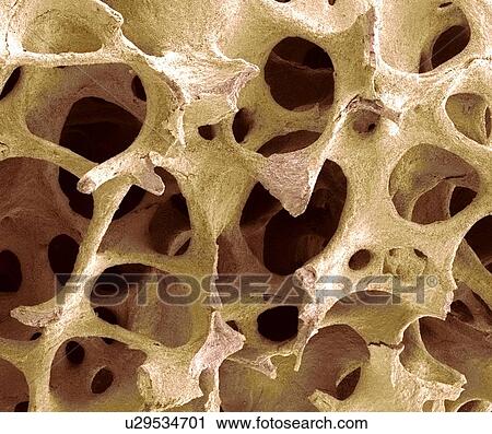 Stock Image - Bone tissue, SEM. Fotosearch