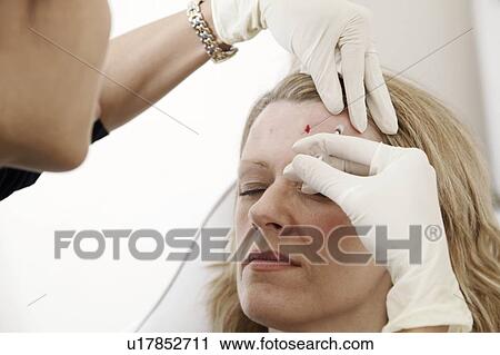 Stock Image - BOTOX® treatment. Fotosearch