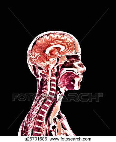 Brain and spinal cord View Large Photo Image Stock Photograph - Brain and spinal cord. Fotosearch