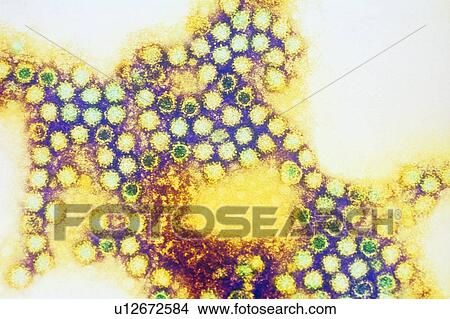 Picture - Caliciviruses. Fotosearch