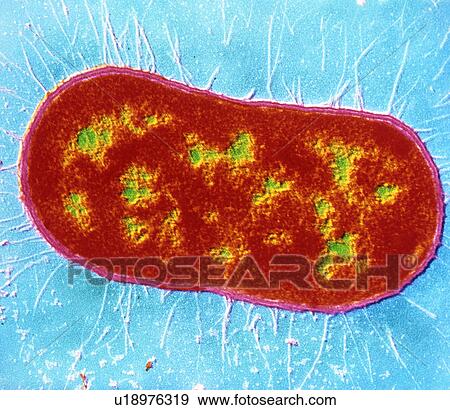 Calymmatobacterium sp. bacterium View Large Photo Image Stock Photo - Calymmatobacterium sp. bacterium. Fotosearch