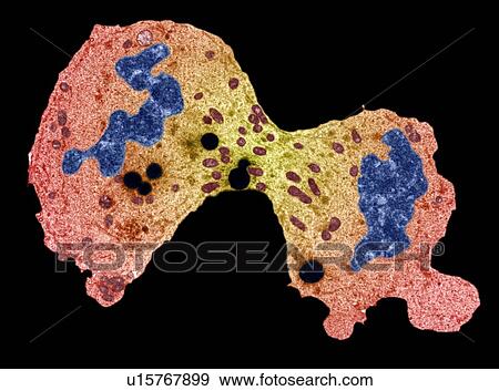 Cancer cell division, TEM View Large Photo Image Stock Photo - Cancer cell division, TEM. Fotosearch