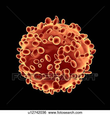 Cancerous tumour, artwork View Large Photo Image Stock Photograph - Cancerous tumour, artwork. Fotosearch