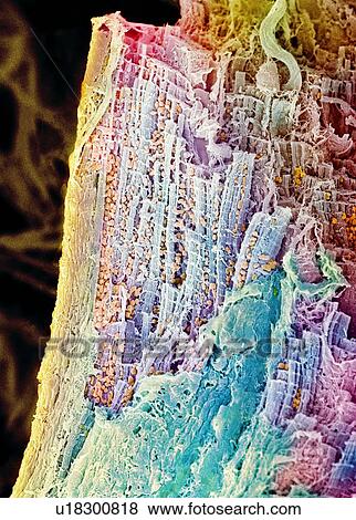 Cardiac muscle, SEM View Large Photo Image Stock Photo - Cardiac muscle, SEM. Fotosearch
