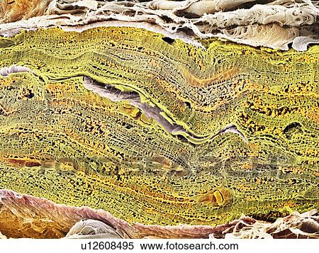 Cardiac muscle, SEM View Large Photo Image Stock Photography - Cardiac muscle, SEM. Fotosearch