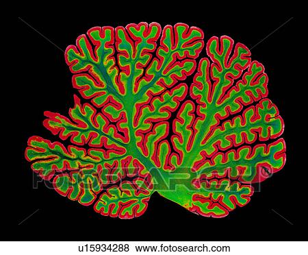 Stock Photo - Cerebellum structure, light micrograph. Fotosearch