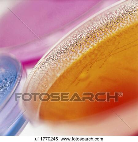 Stock Photography - Close-up of petri dishes with bacterial cultures. Fotosearch
