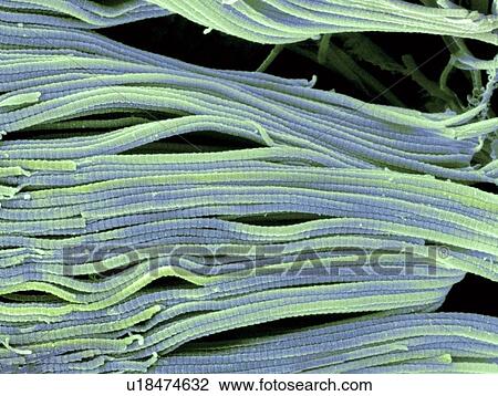 Stock Image - Collagen, SEM. Fotosearch