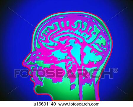 Coloured MRI scan of the human head (side view) View Large Photo Image Stock Image - Coloured MRI scan of the human head (side view). Fotosearch