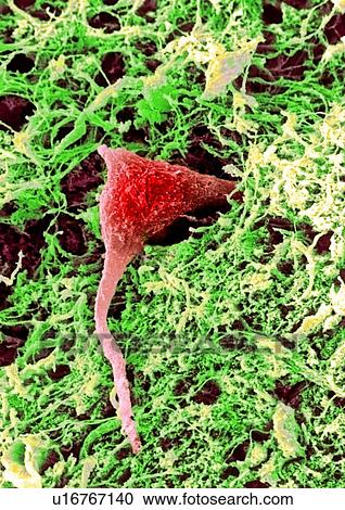 Stock Image - Coloured SEM of a nerve cell in brain tissue. Fotosearch
